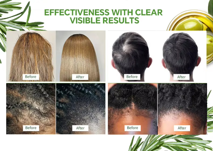 Private Label Organic Rosemary Oil Hair Growth Healthy Scalp Biotin Nourishing Serum Strengthening Hair Treatment Oils