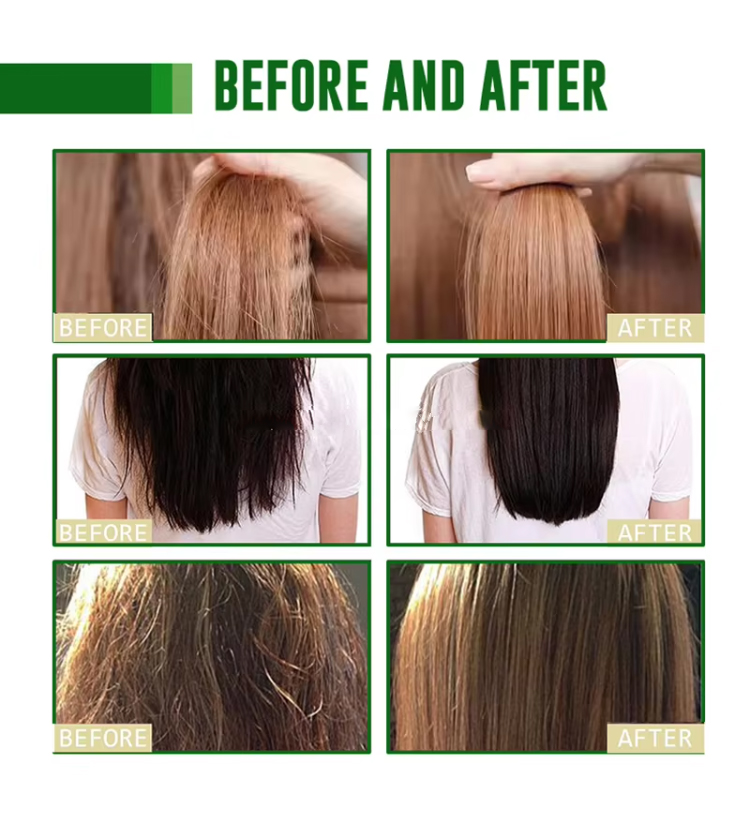 Private Label Organic Rosemary Oil Hair Growth Healthy Scalp Biotin Nourishing Serum Strengthening Hair Treatment Oils