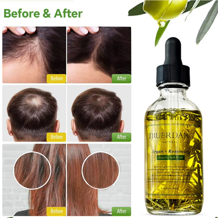 Private Label Organic Rosemary Oil Hair Growth Healthy Scalp Biotin Nourishing Serum Strengthening Hair Treatment Oils